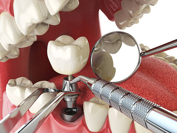 Best Broken Tooth Emergency  in Laurel, MT